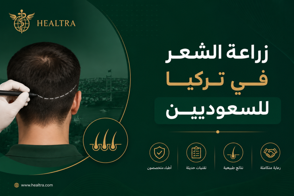 زراعة الشعر في تركيا للسعوديين
